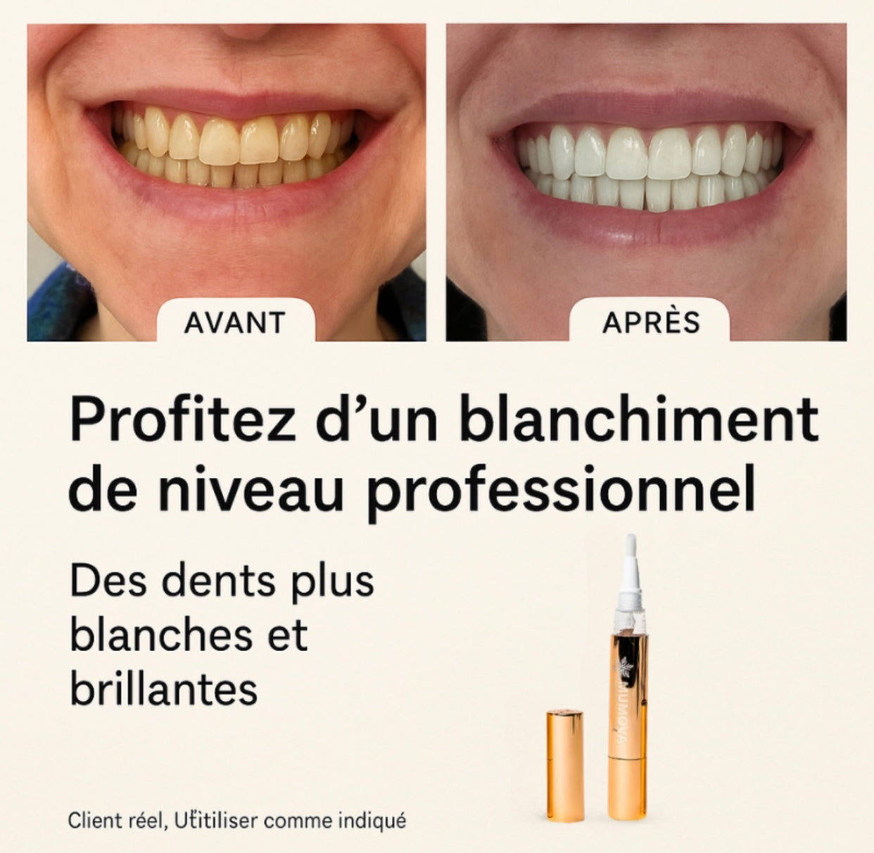 SMILUX™ / Stylo Blanchissant Express